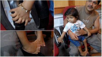 Can-Do-Ability: The Boy Who Can Count To 34 On His Fingers And Toes